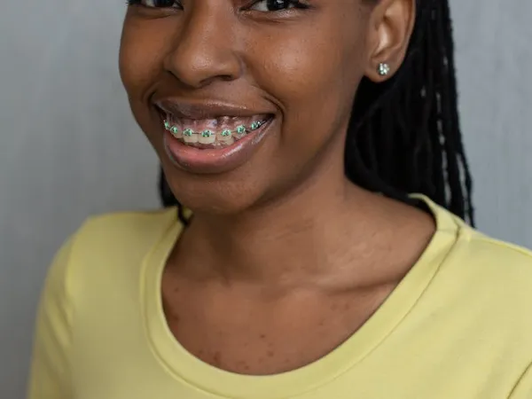 Smiling with confidence during orthodontic treatment