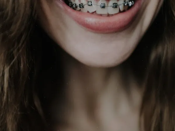 Showing off a beautiful smile transformation