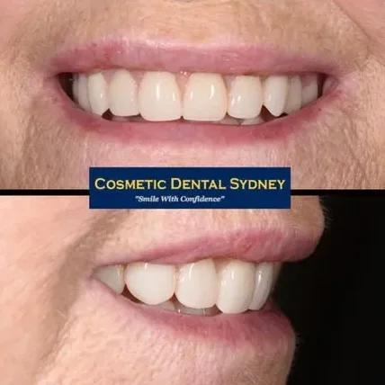 Smile Makeover 3