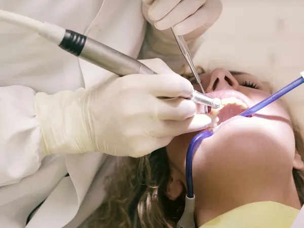 Fillings
